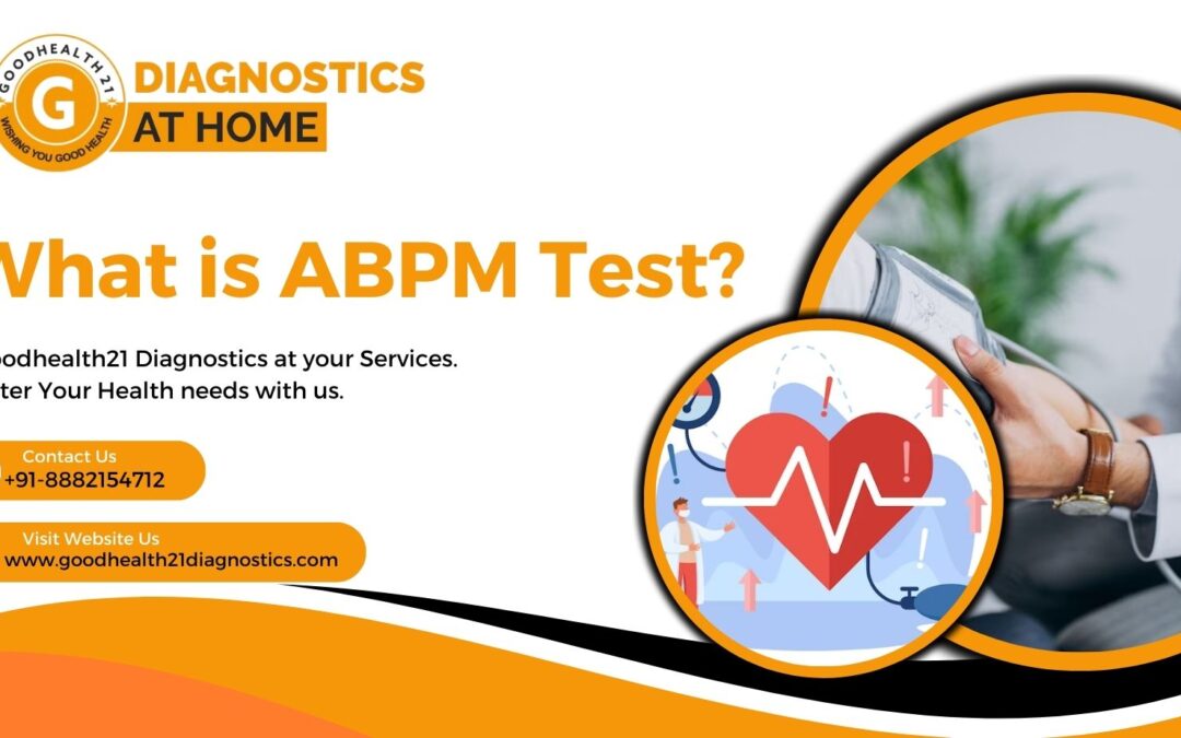 what is abm test