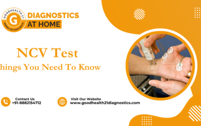 Things You May Not Know About the NCV Test